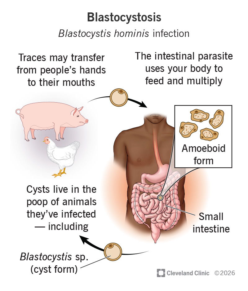 Blastocystis hominis transfers from the poop of animals they’ve infected to your intestine, where they feed and multiply