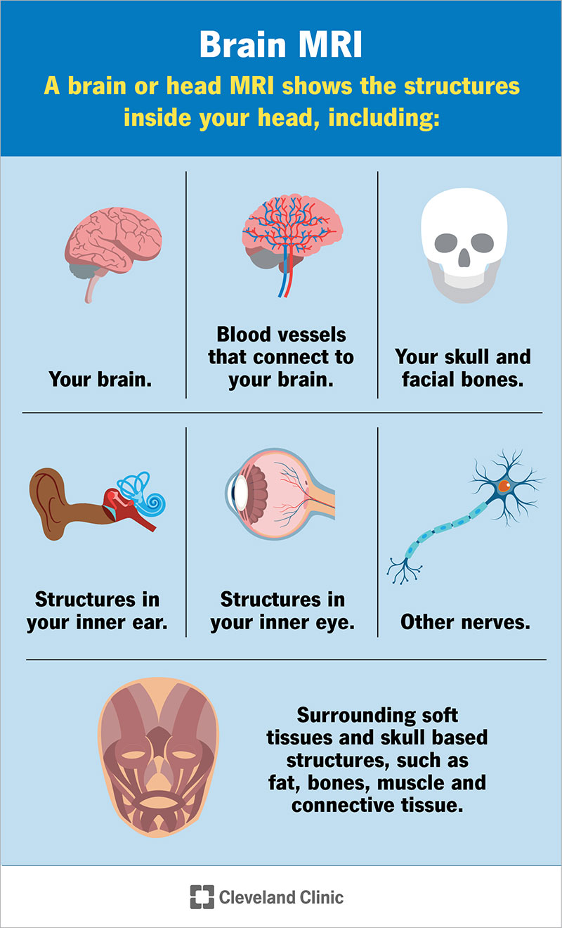 A brain or head MRI shows your brain, blood vessels, skull, structures in your inner ear and inner eye and more.