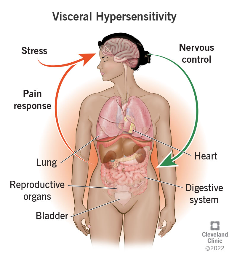 visceral-hypersensitivity-symptoms-treatment-causes-what-it-is