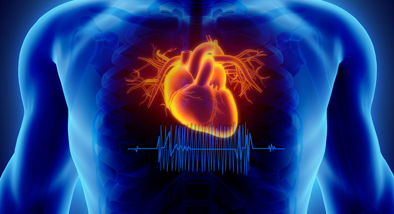 What Does A Holosystolic Murmur Indicate