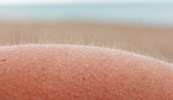 A close look at vellus hair (peach fuzz) on a person’s skin.