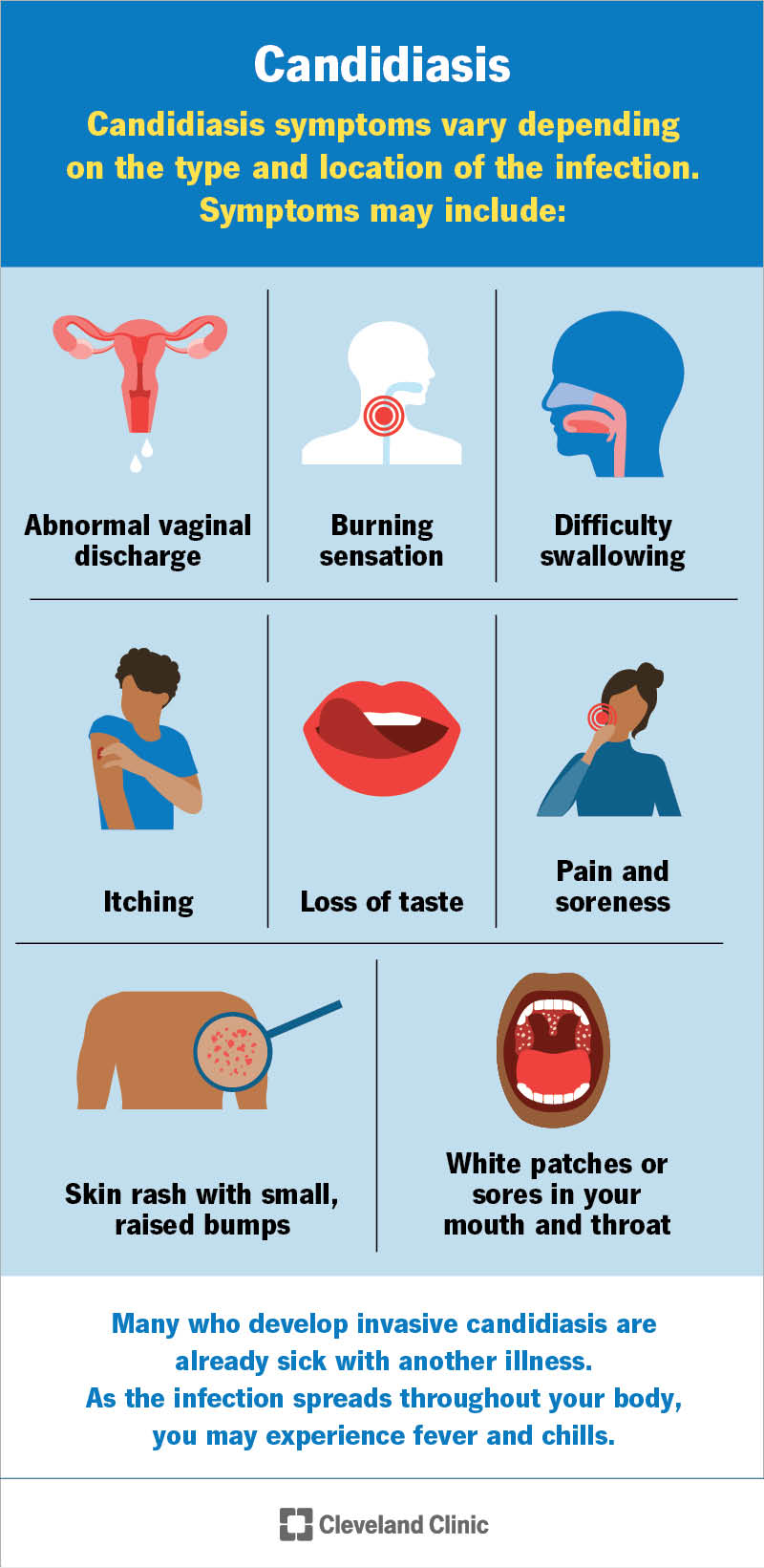 A candidiasis infection causes symptoms that commonly affect your skin, mouth, throat or vagina