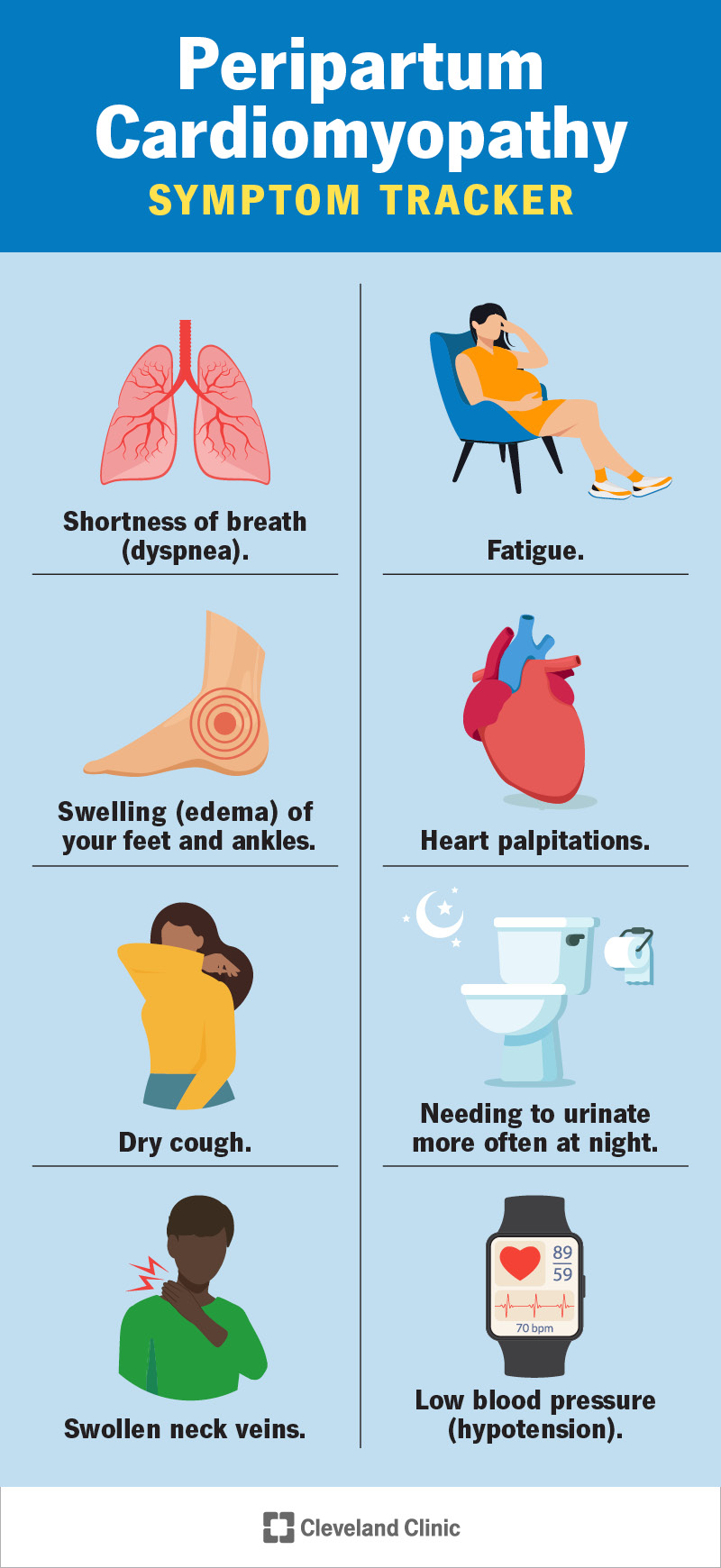 Peripartum (Postpartum) Cardiomyopathy: Symptoms and Treatment