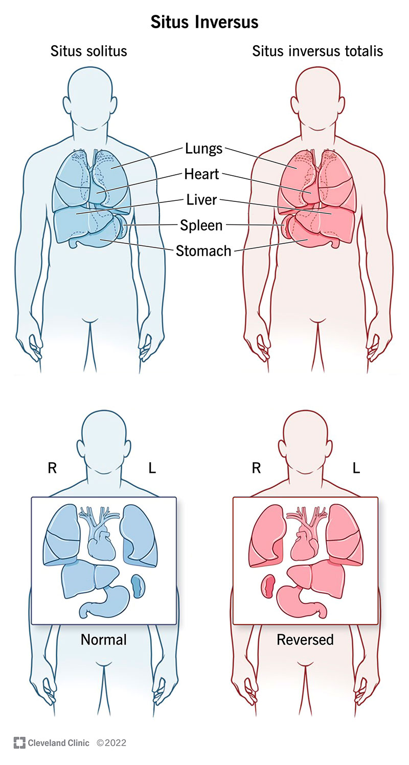 abnormal body parts