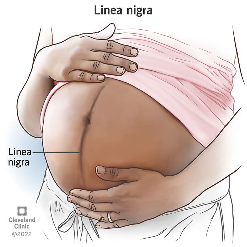 A linea nigra line running from the pubic bone to the ribs on a dark-skinned pregnant person.