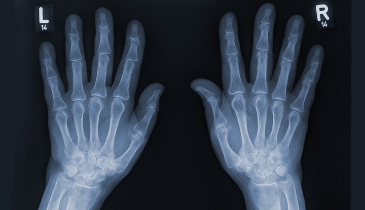 Hand X-ray shows the inner structures of the hands.