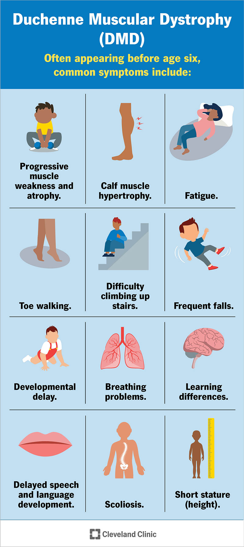 Symptoms of DMD often appear before age 6 and include fatigue, difficulty walking up stairs, frequent falls, developmental delay and more.