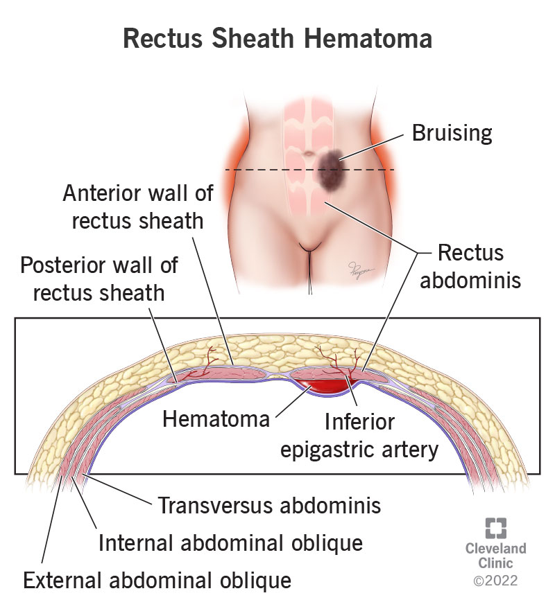 belly button inside diagram