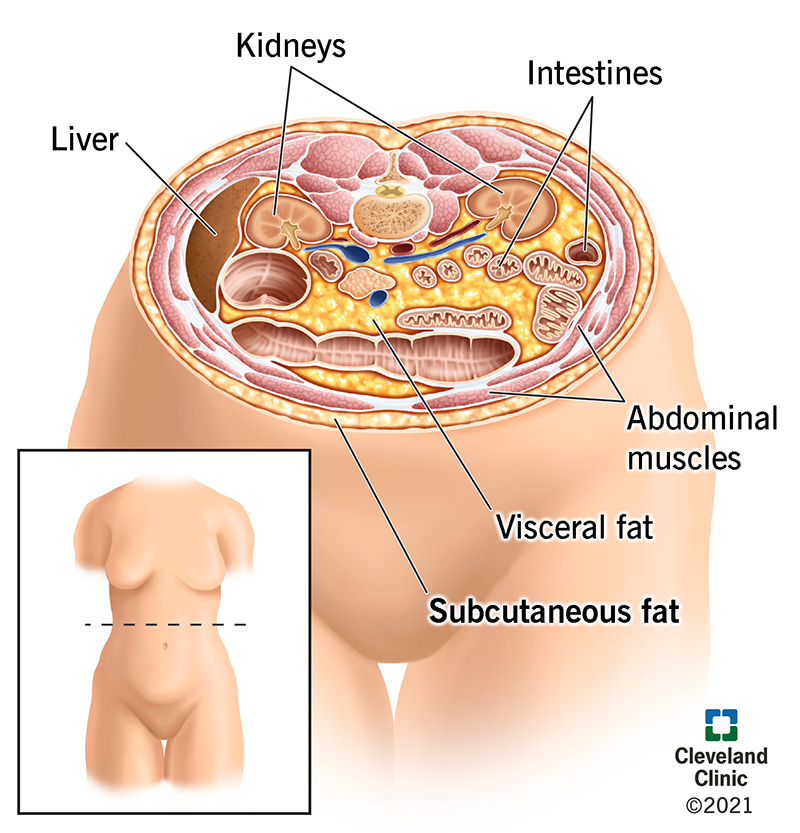 Subcutaneous fat is the fat you can pinch just under your skin. It differs from visceral fat, which surrounds your abdominal organs.