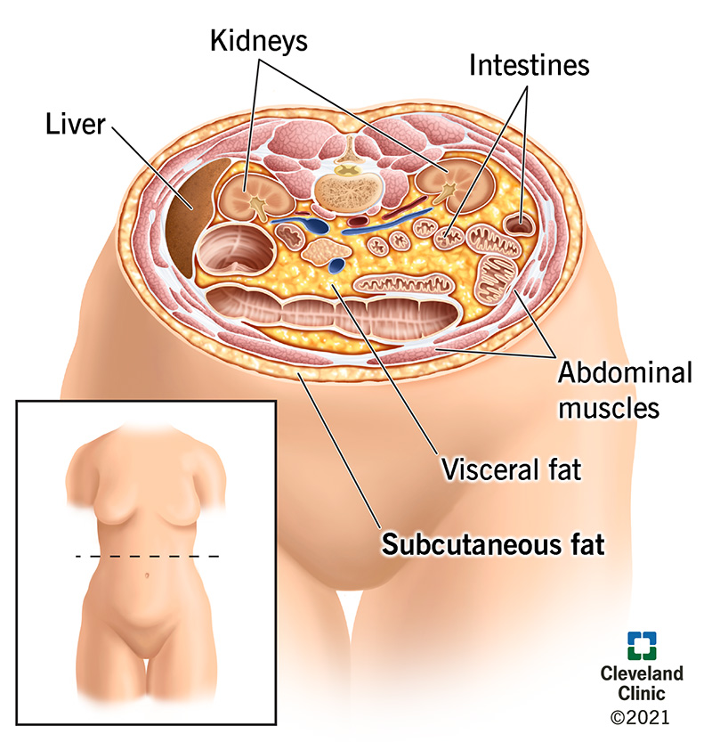 Subcutaneous fat accumulation