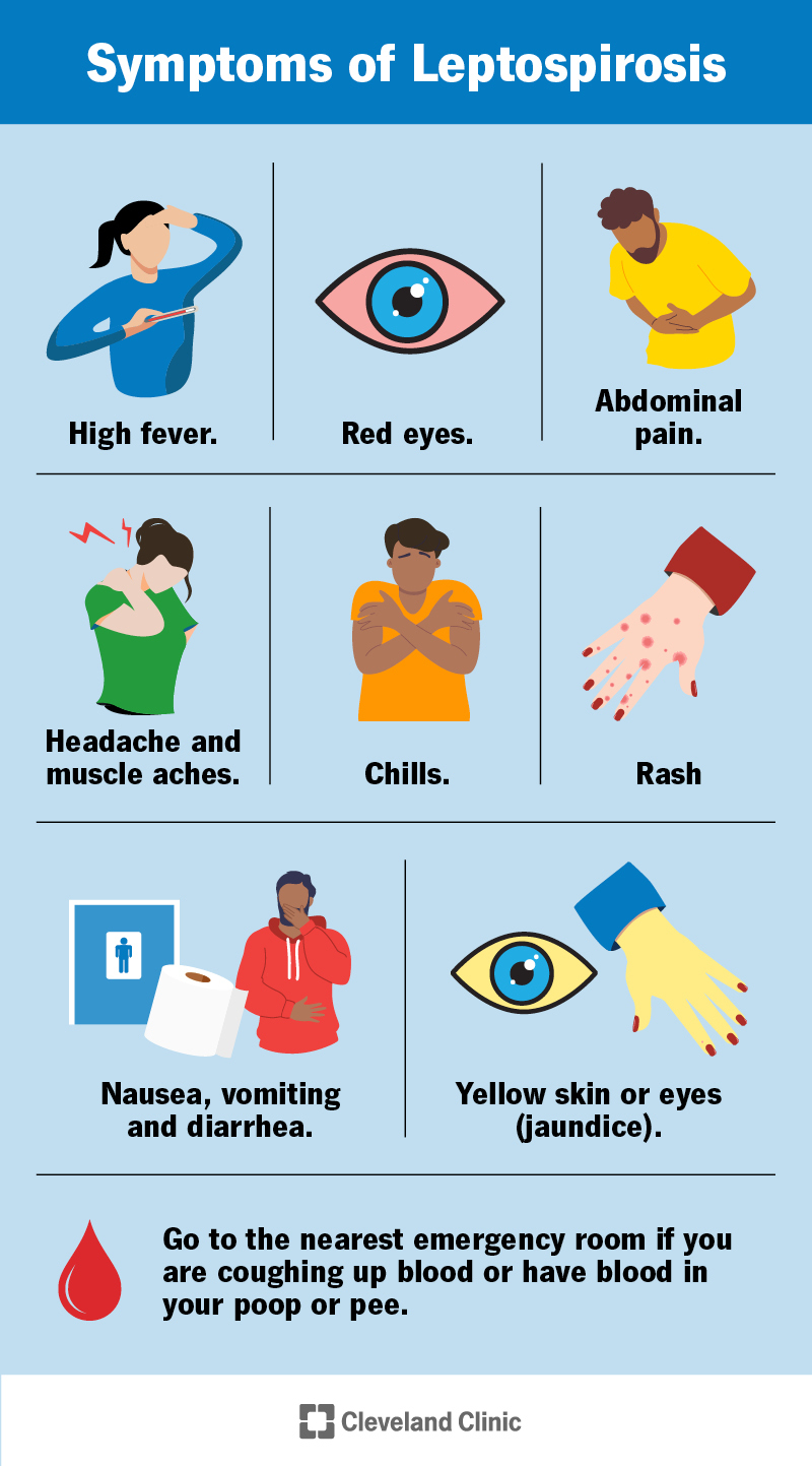 Symptoms of leptospirosis include high fever, red eyes, headache, muscle aches, abdominal pain, yellow skin or eyes and more.