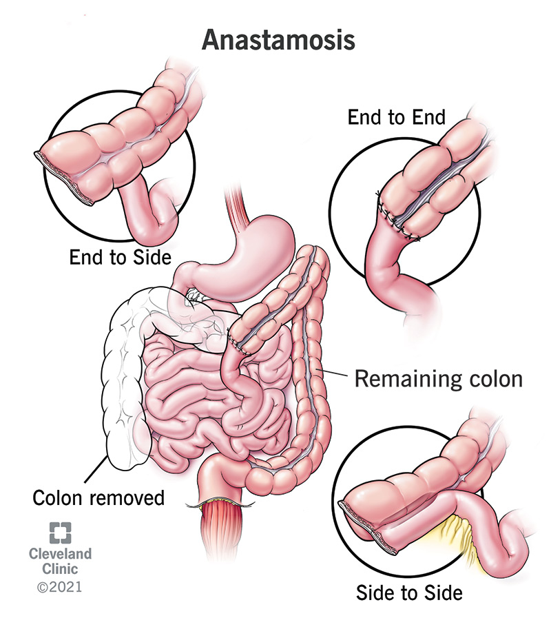 Location is important: differentiation between ileal and colonic