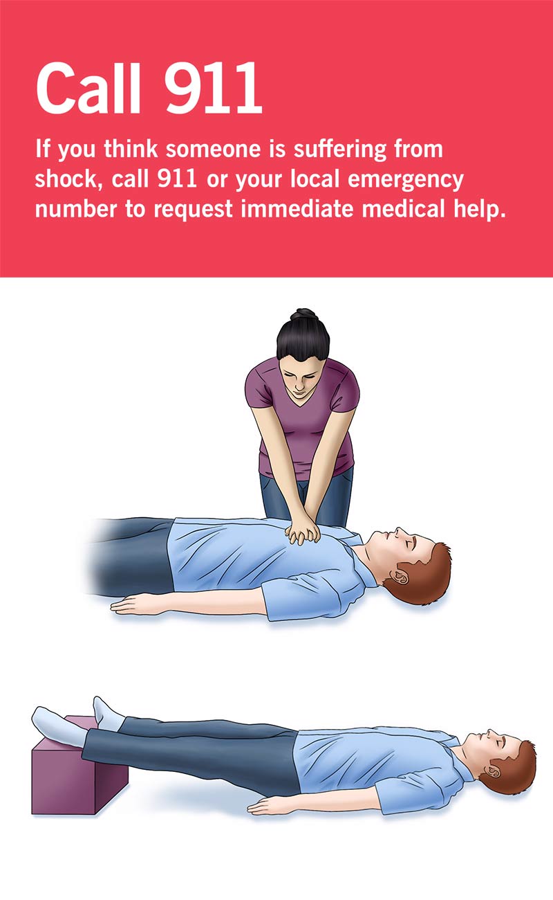 The steps involved in shock first aid treatment include calling 911, performing CPR and laying the person down with their legs elevated.