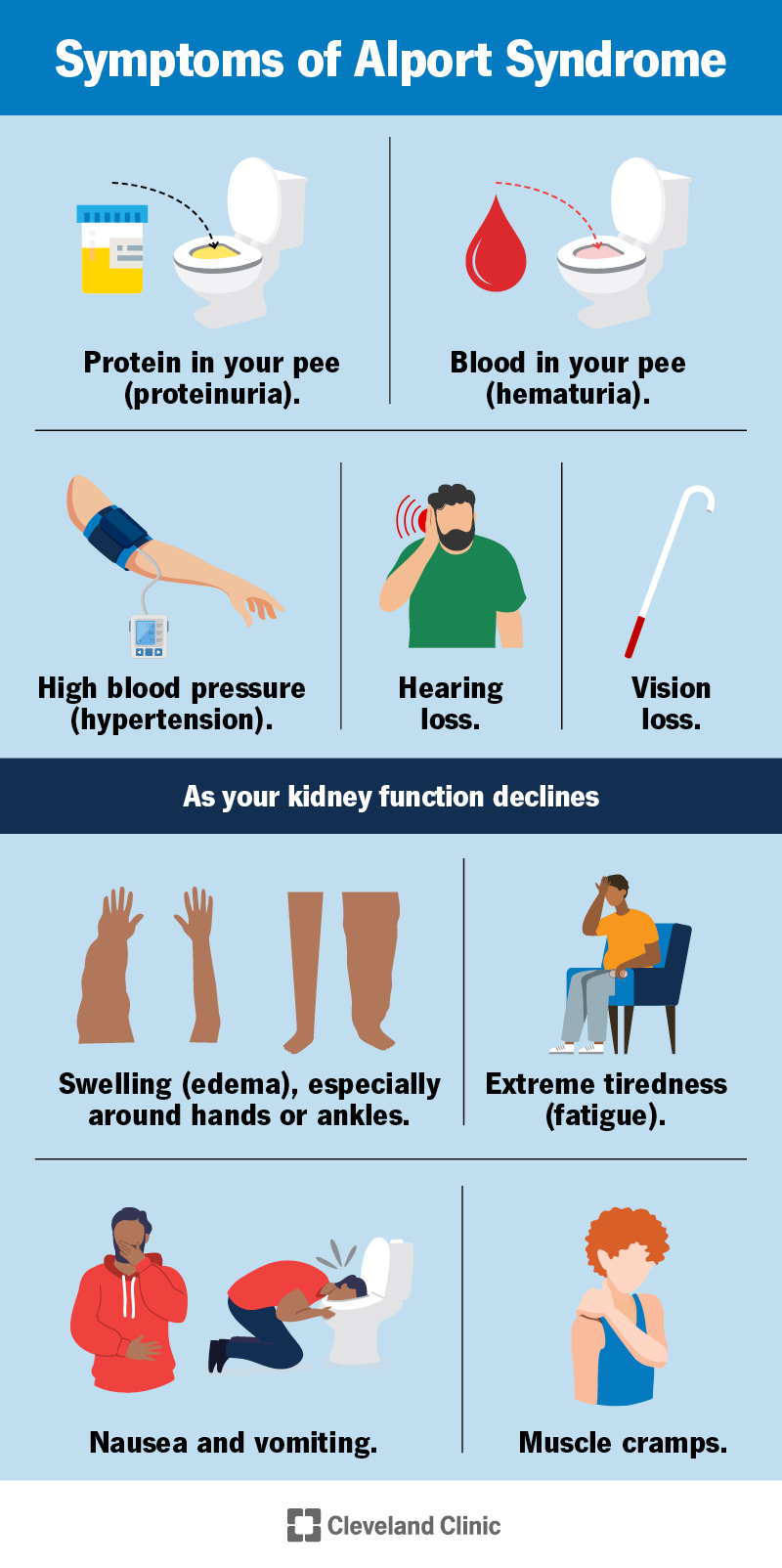 People with Alport syndrome commonly have symptoms that affect their pee, blood pressure, sight and hearing. As their kidneys get worse, they may develop swelling and other symptoms.