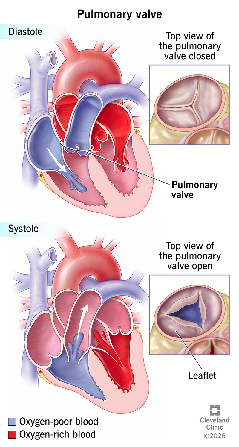 Heart anatomy with blood flow through pulmonary valve during diastole and systole, and top views of open versus closed valve