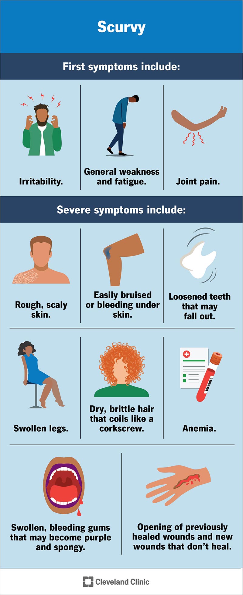 The first symptoms of scurvy may develop after a few months of vitamin C deficiency.