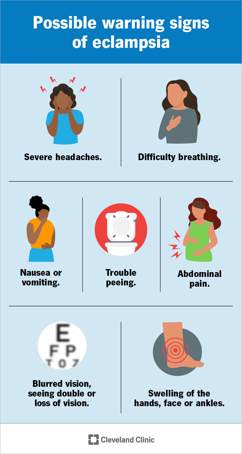 Warning signs of eclampsia