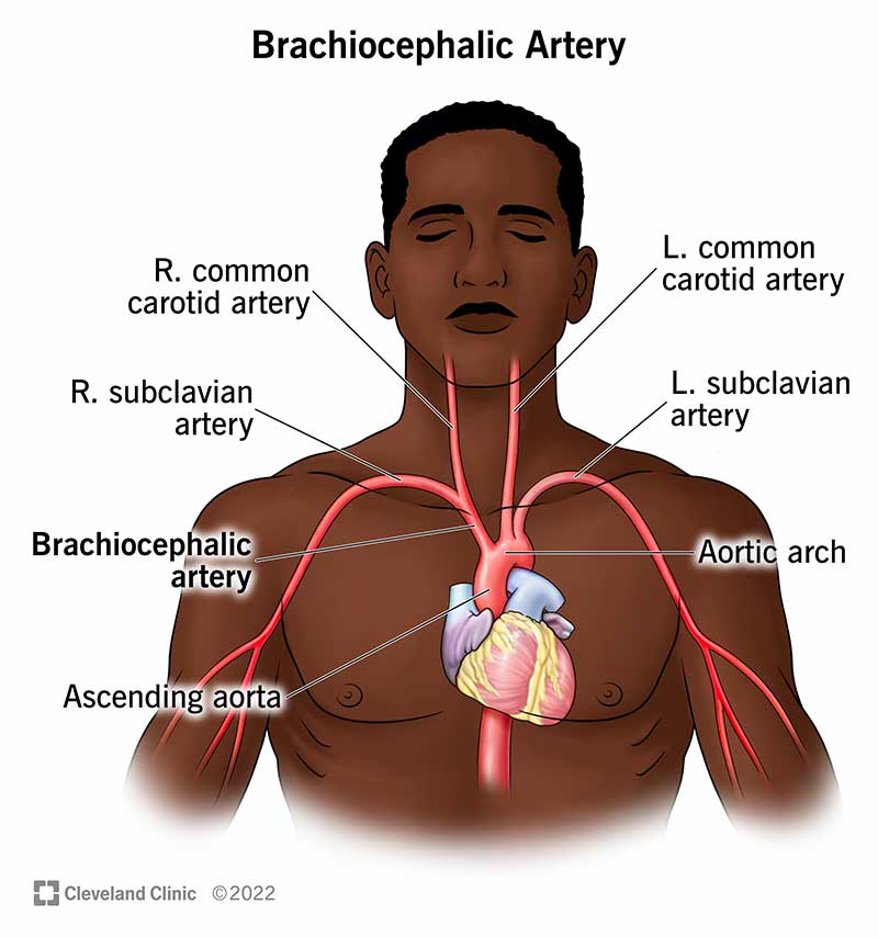 Your brachiocephalic artery branches from your aortic arch in your upper chest.