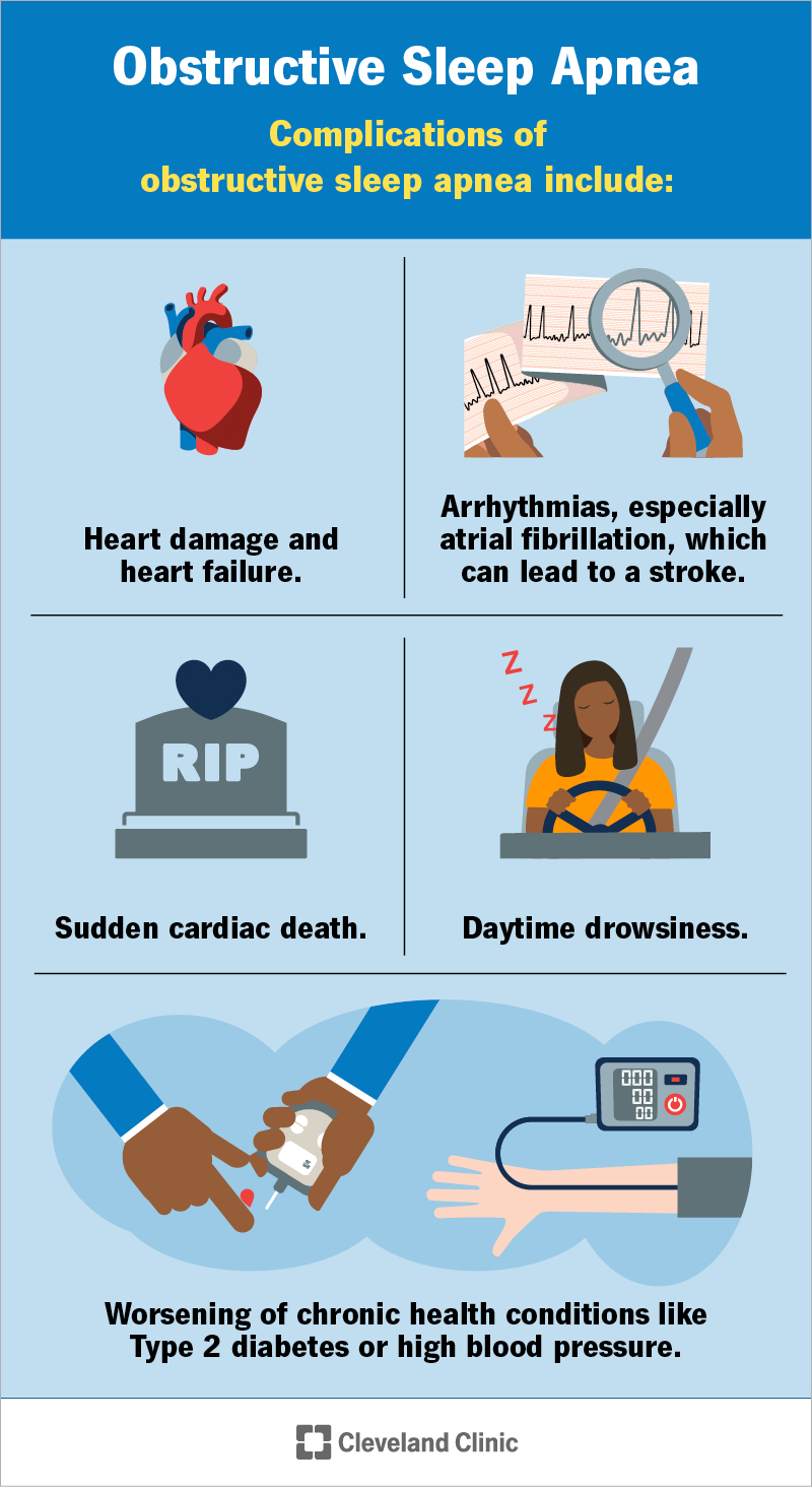 Obstructive sleep apnea can raise your risk of many health problems, especially developing heart failure or having a stroke.