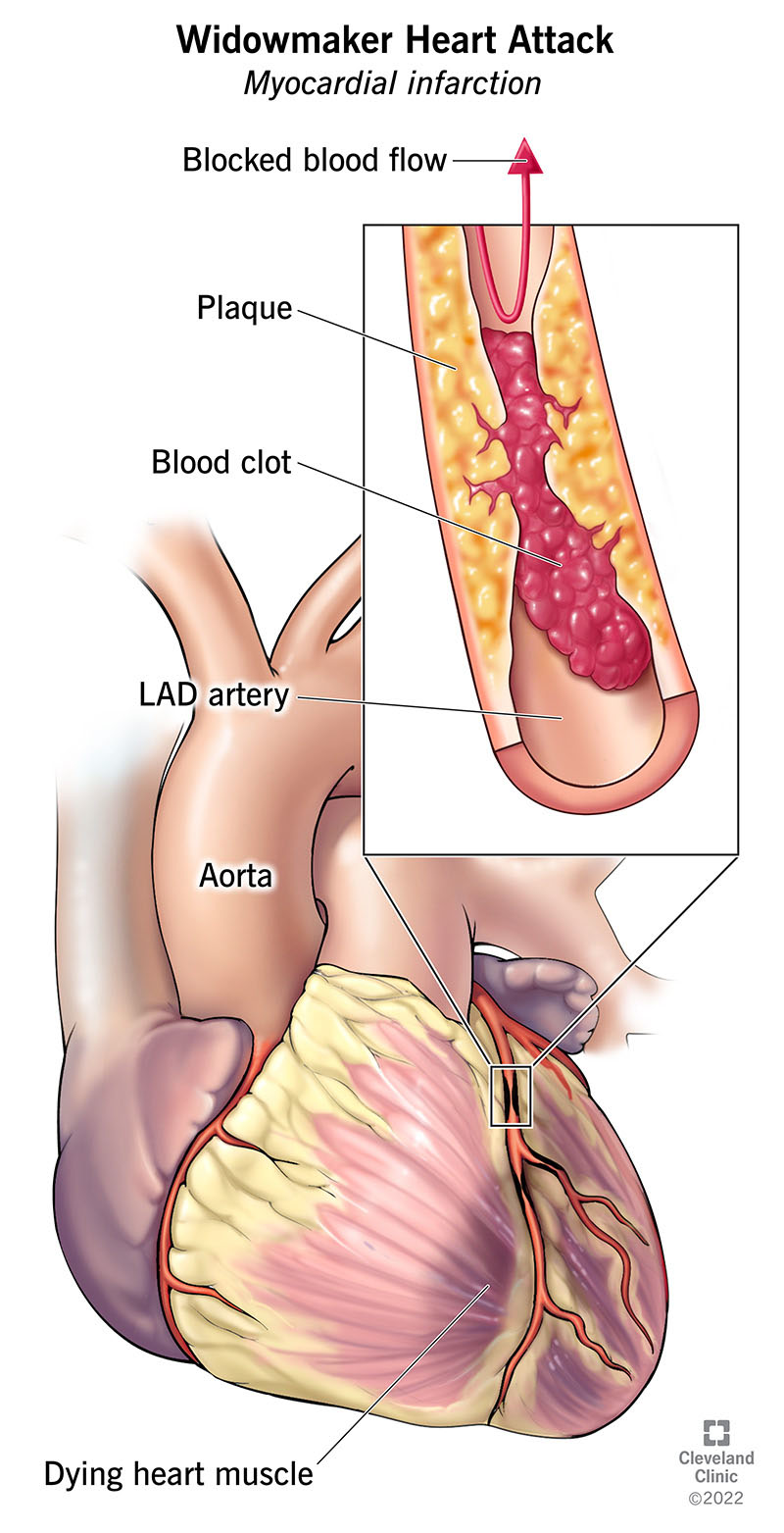 four major coronary arteries