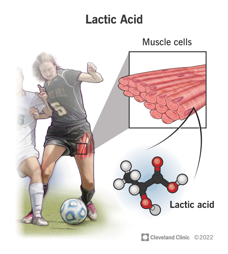 An illustration of a lactic acid molecule in a soccer player's muscle fibers