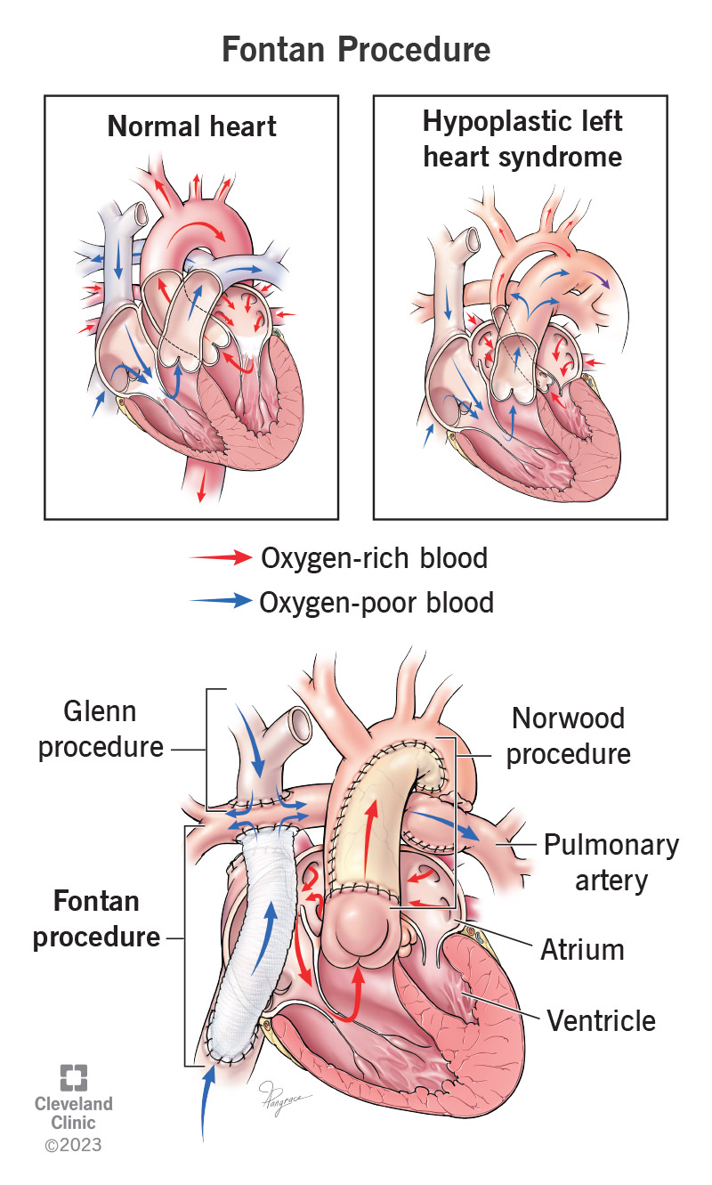 normal heart blood flow - Dayton Children's Hospital