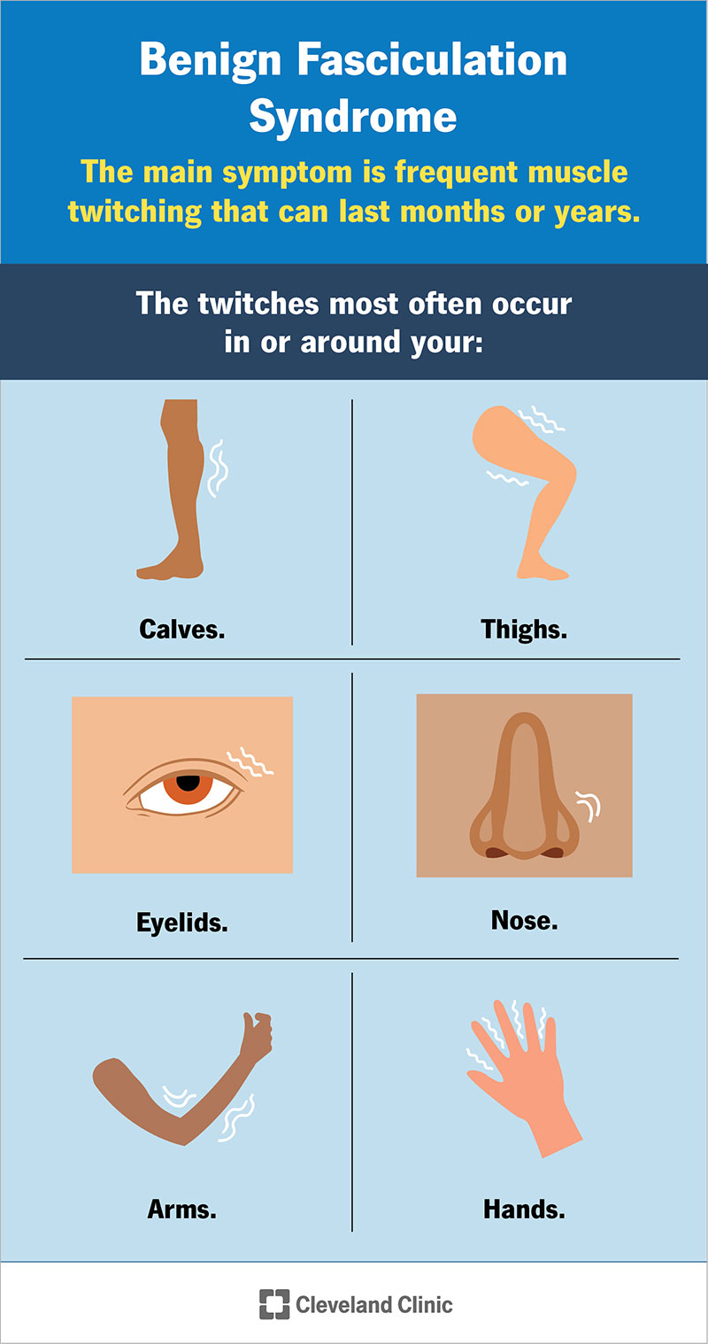 The twitches most often occur in or around your calves, thighs, eyelids, nose, arms and/or hands.