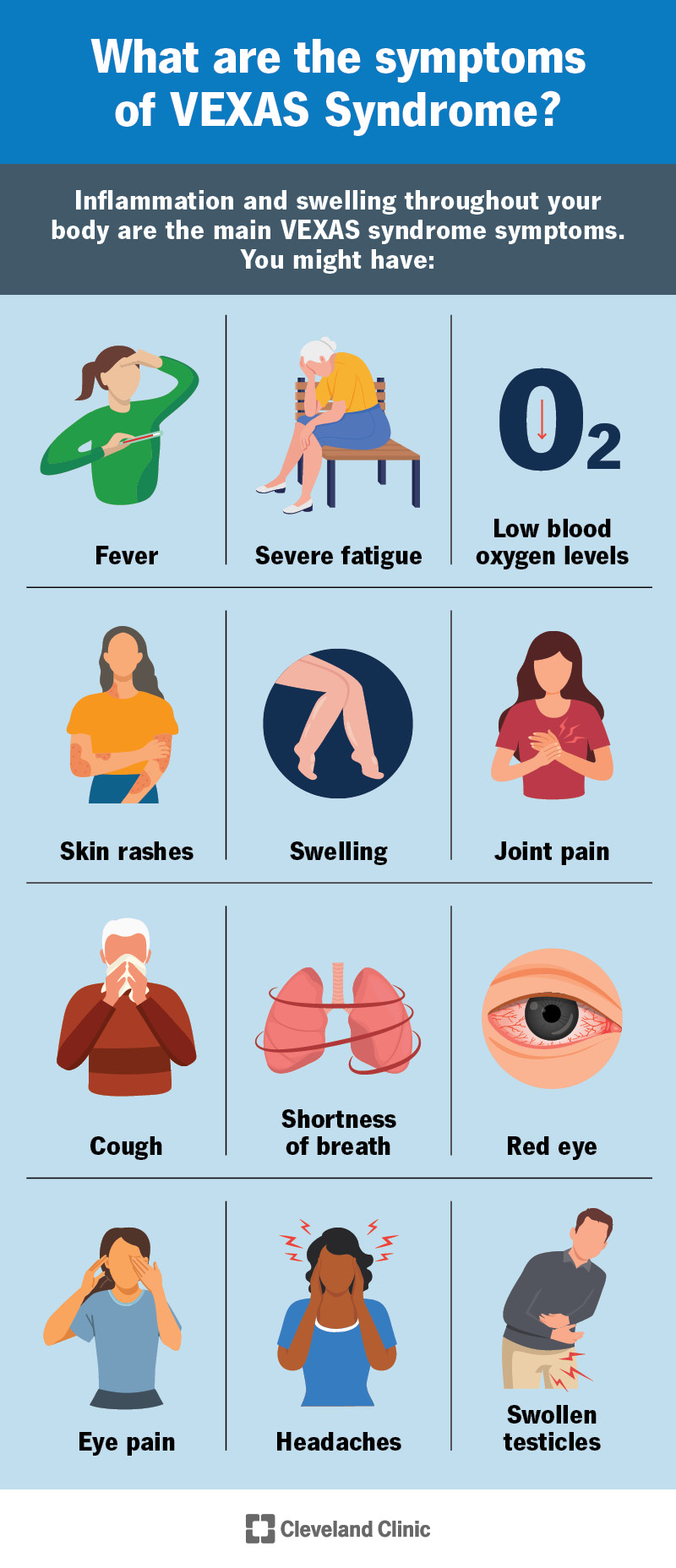 The main VEXAS syndrome symptoms are inflammation and swelling throughout your body