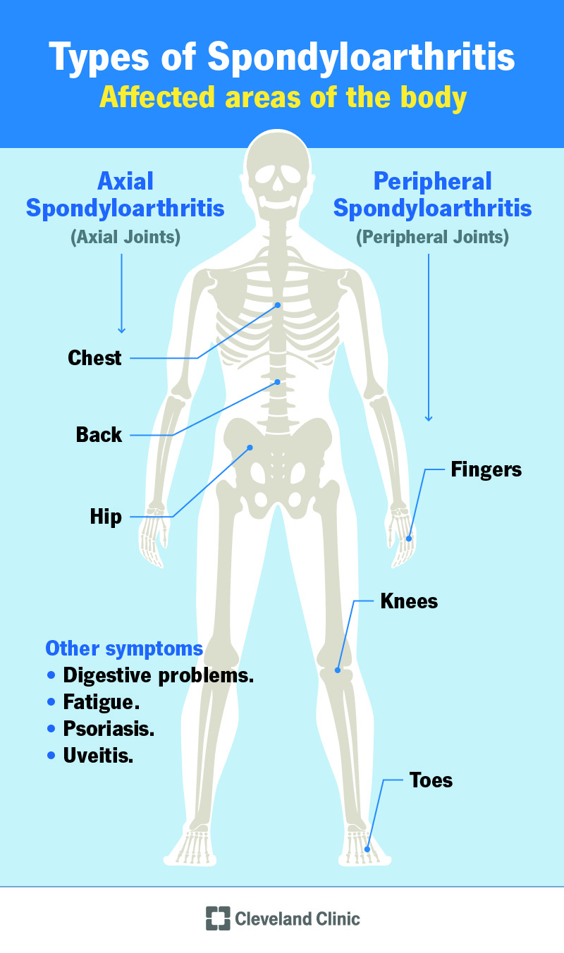 Axial and peripheral joints labeled on a skeleton.