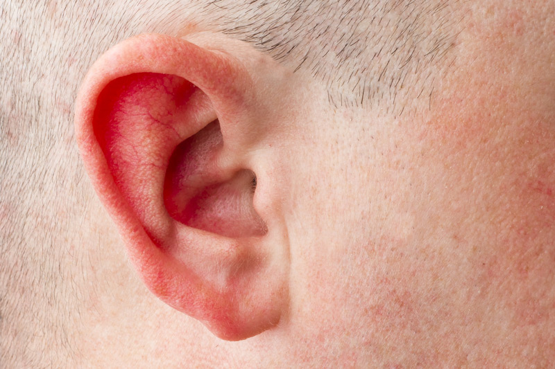 Red and hot (burning) ears: causes and treatment