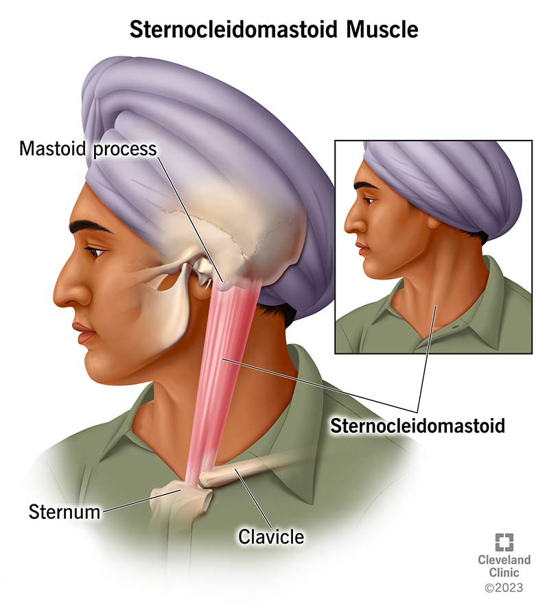Side view of the sternocleidomastoid muscle in the neck.