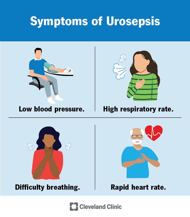 Common signs of urosepsis are low blood pressure, high respiratory rate, difficulty breathing and rapid heart rate.