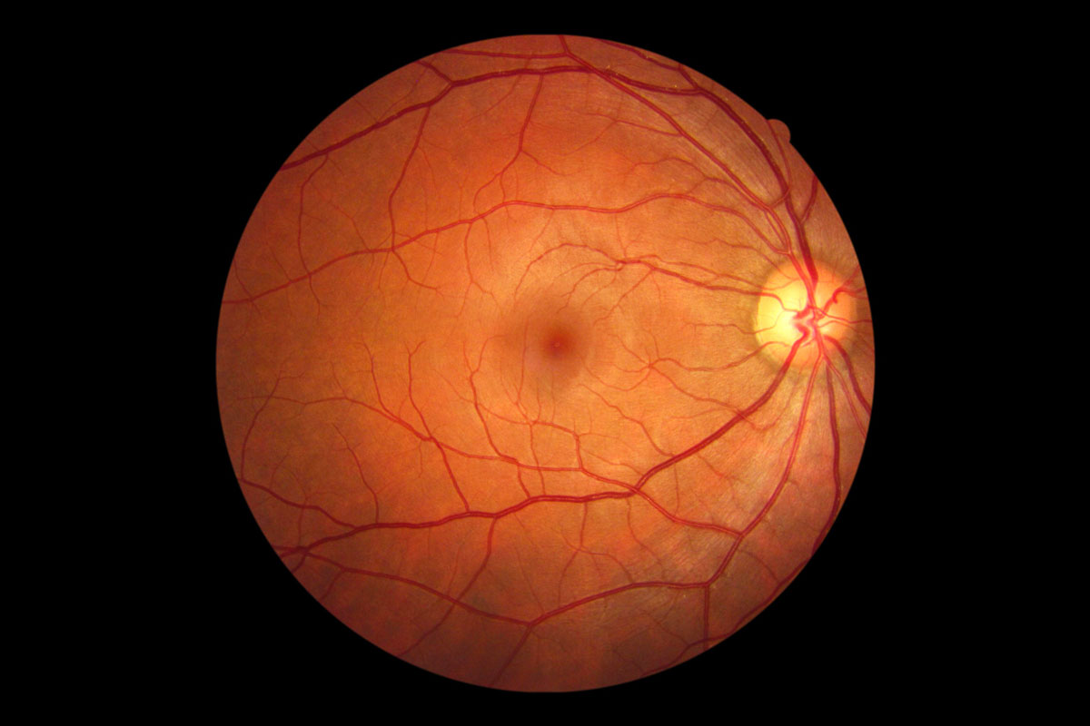 An image of the back of your eye that retinal imaging technologies can produce.
