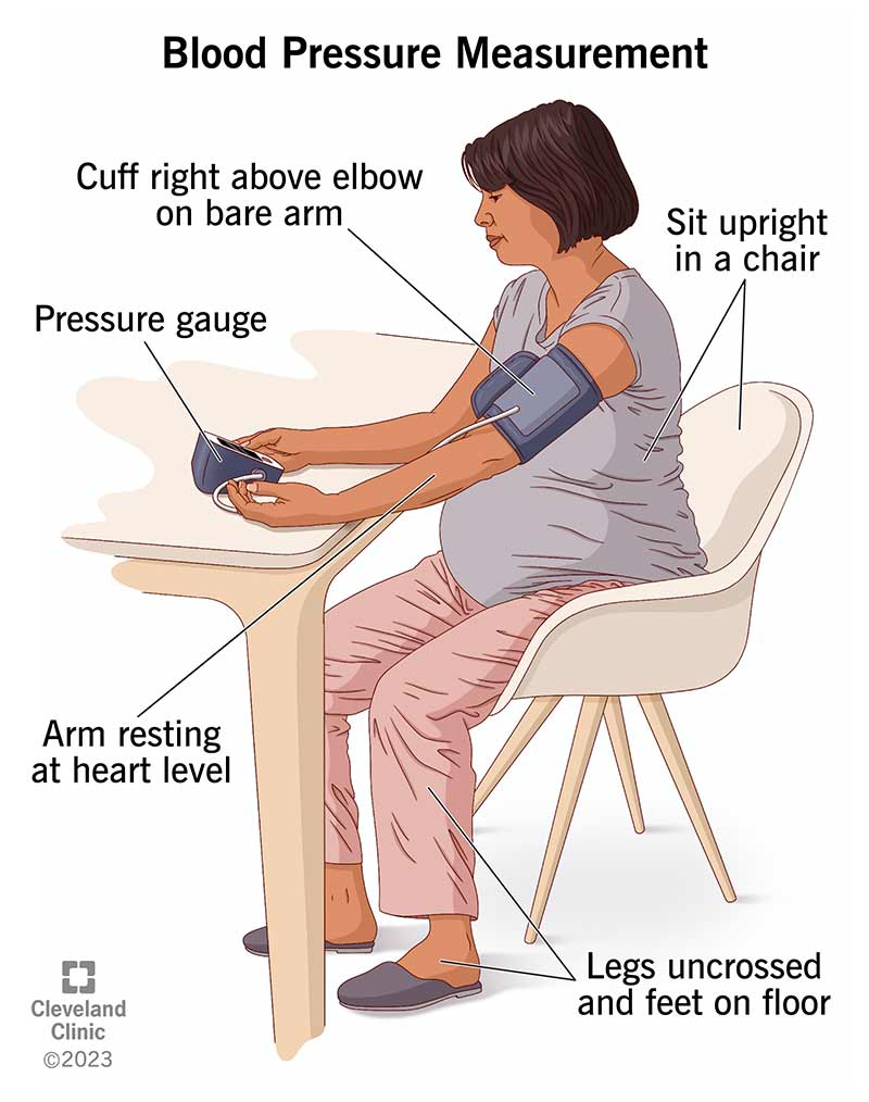 Preparing for a BP measurement includes sitting upright, relaxing your arm at heart level and not crossing your legs.
