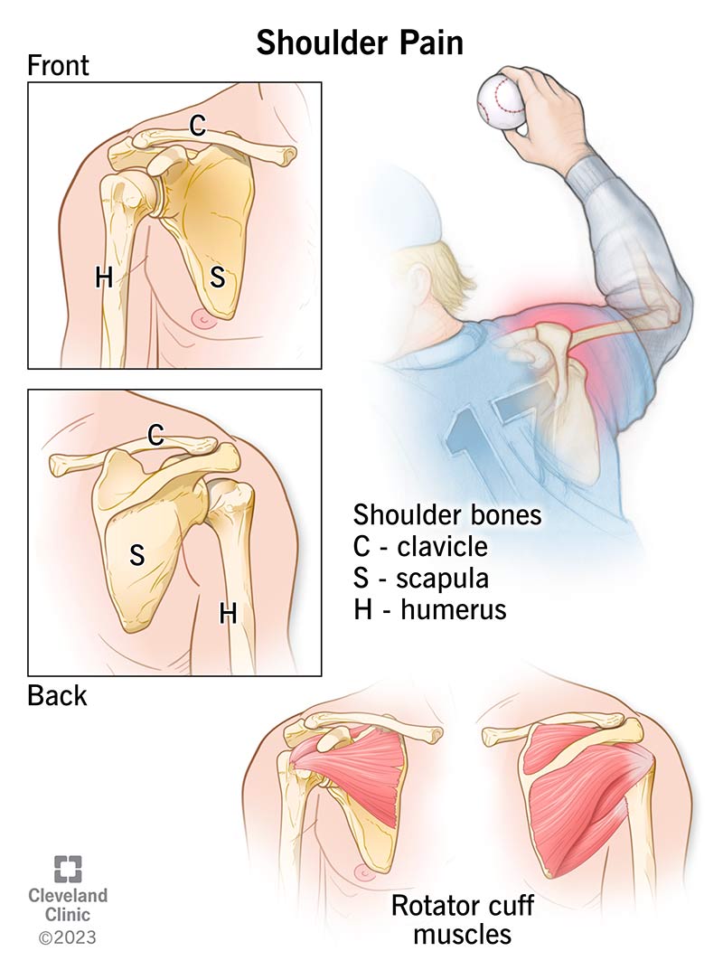 The bones and muscles in and around your shoulder joint that can cause shoulder pain.