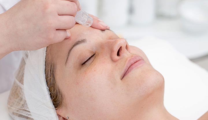 What Is Microdermabrasion and Do You Need It?