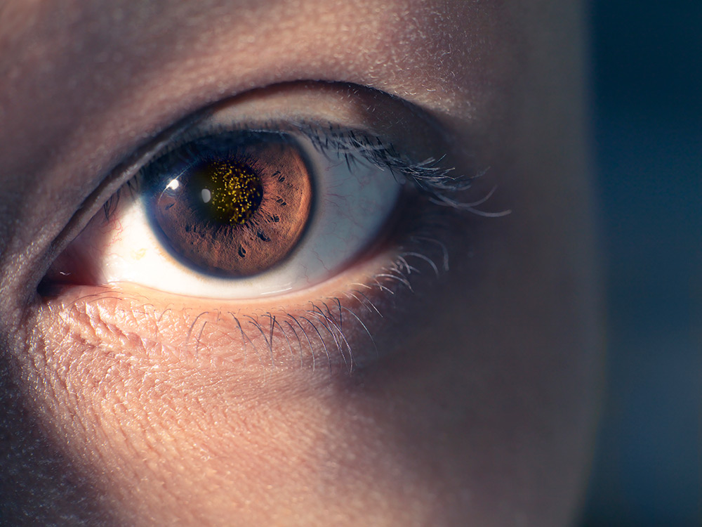 A Black Spot in Vision of One Eye - CorneaCare