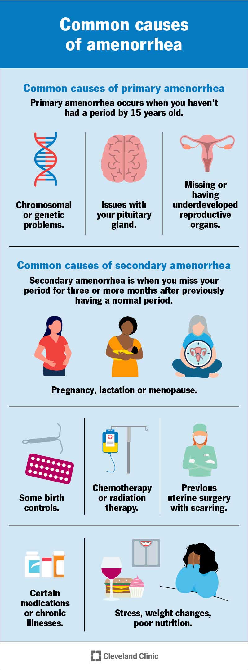 Common causes of primary and secondary amenorrhea.