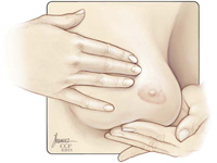 Breast Self-Exam