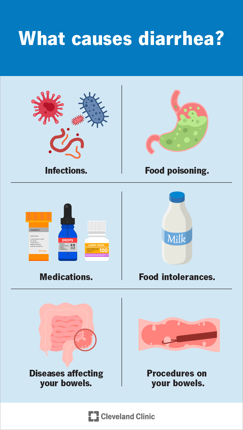 Common causes of diarrhea include medications, food intolerances and food poisoning.