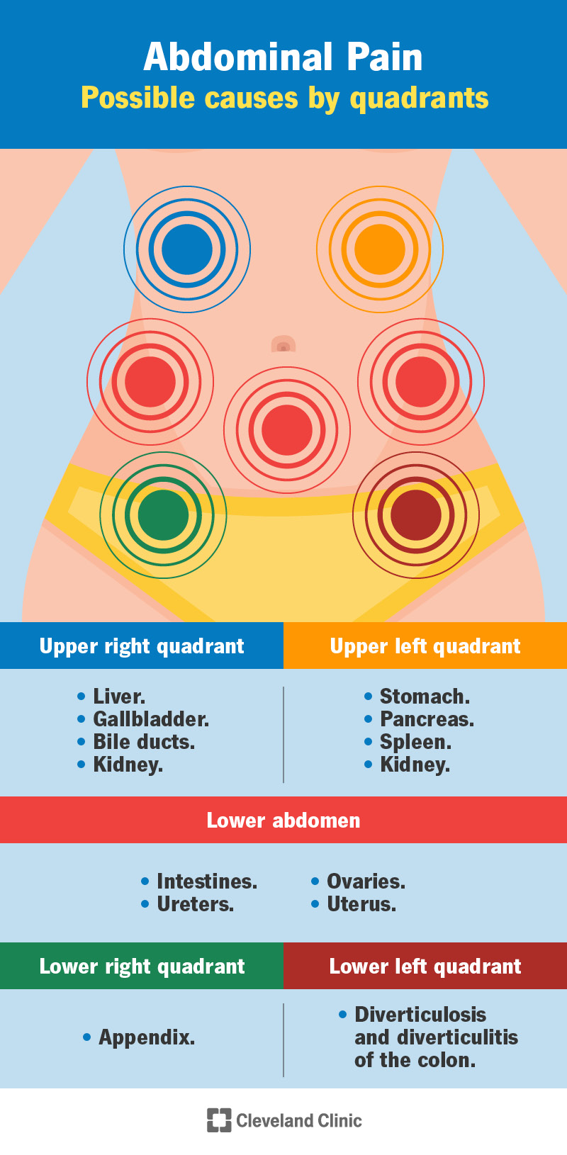 Abdominal pain: possible causes by quadrants.