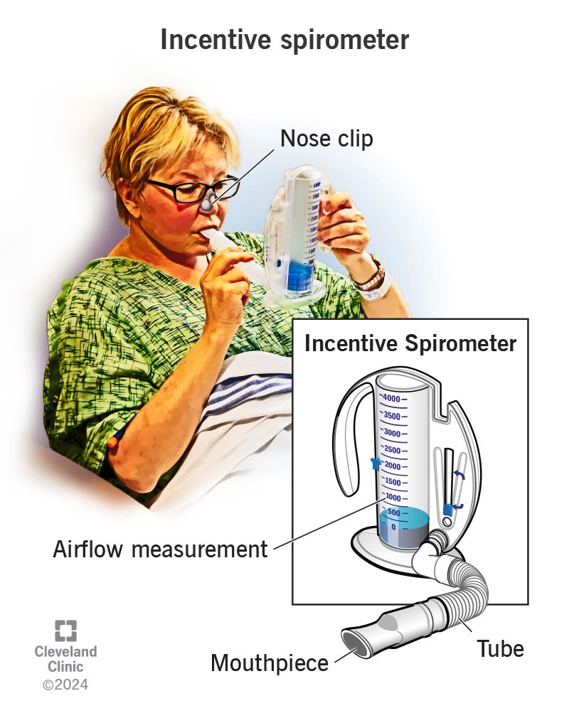 An incentive spirometer is a simple plastic device. The yellow indicator on the side helps track your progress.