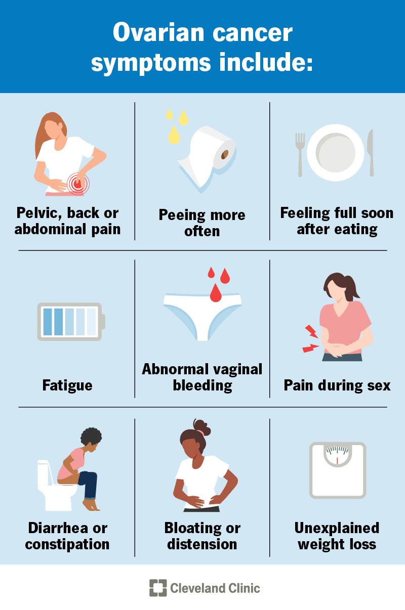 Ovarian cancer symptoms, including pelvic pain, bloating, feeling full soon after eating, unexplained weight loss and more