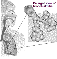 Smoking Asthma Effects Prevention