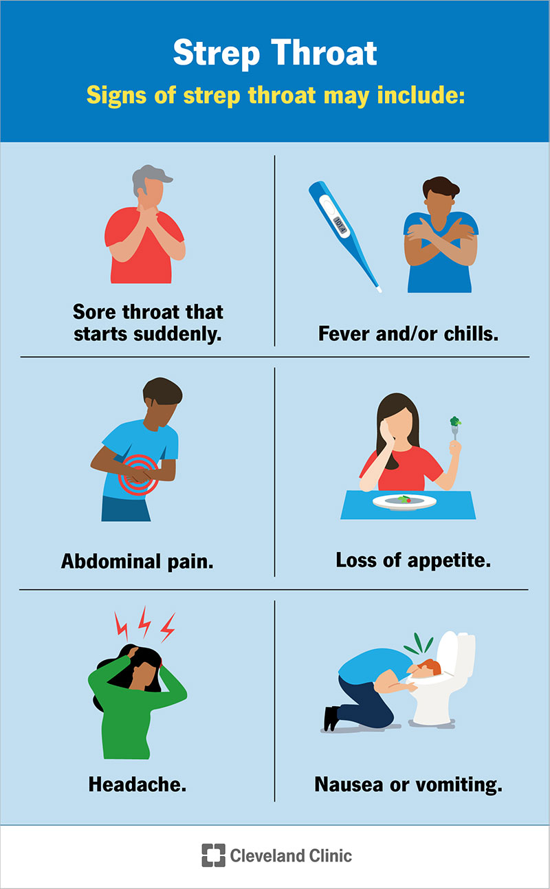 A sudden, severe sore throat is an early symptom of strep throat.