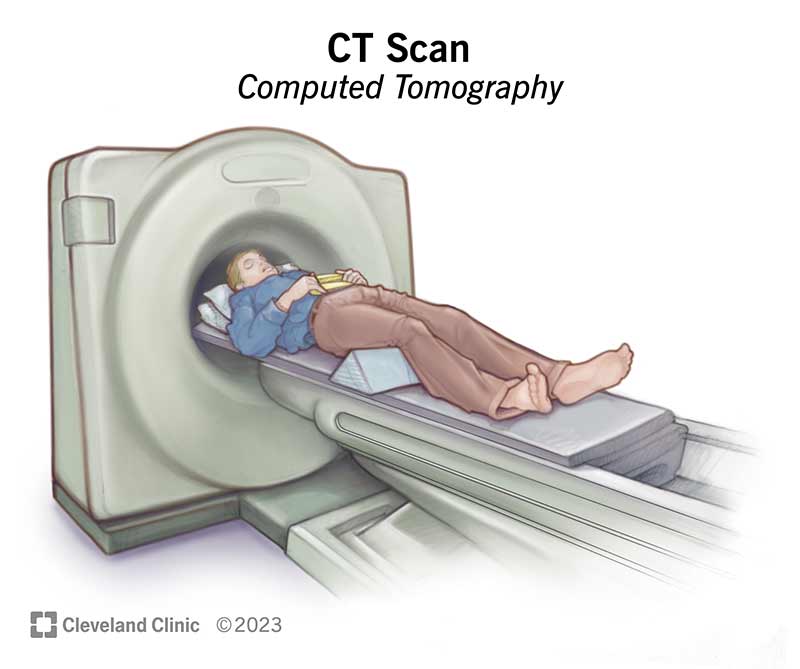 Person laying on table for CT scan; shown entering and inside scanner.