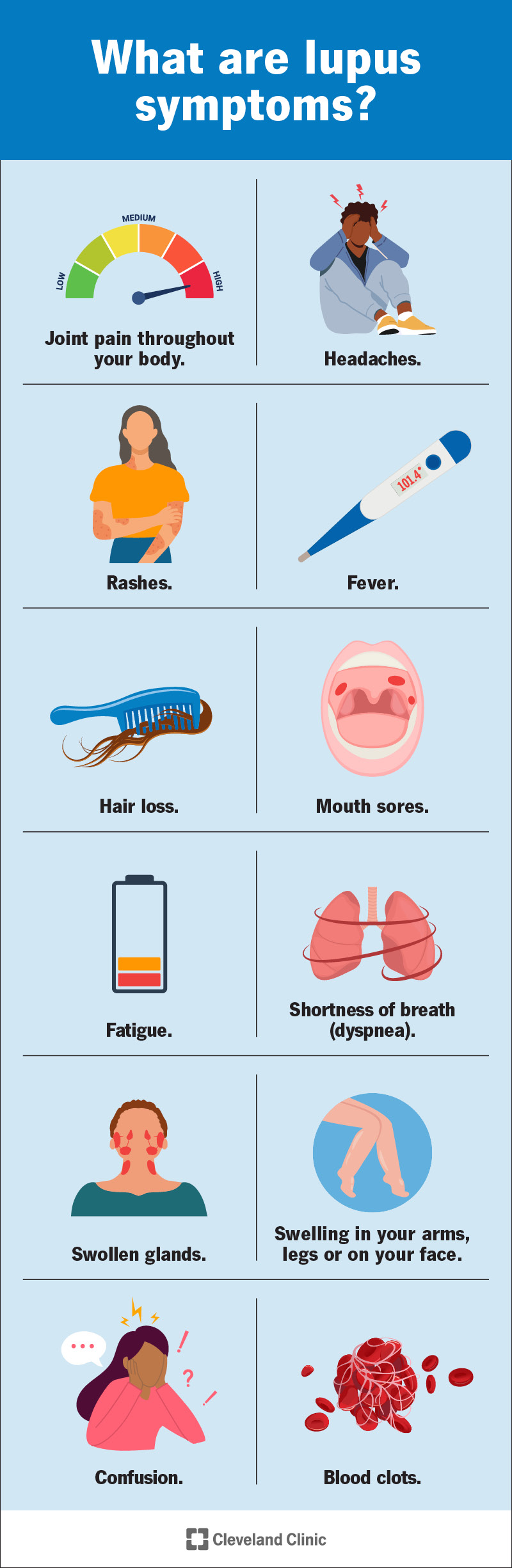 Lupus: Symptoms & Treatment