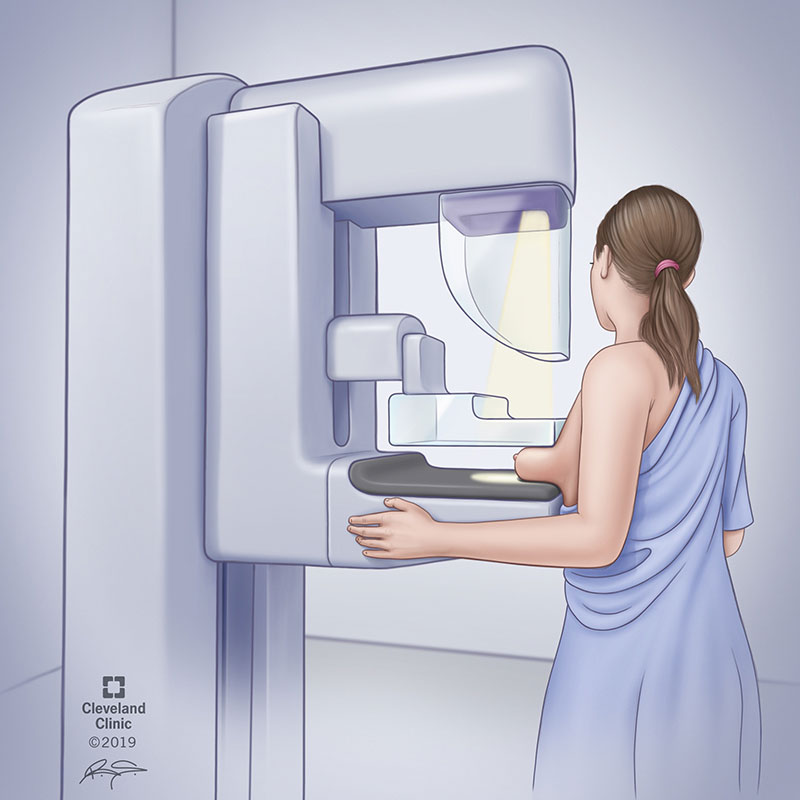 Images from a 3D mammogram (digital breast tomosynthesis).