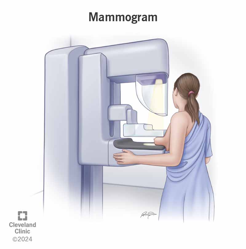 Breast Imaging: 3D Mammography (Tomosynthesis) - Breast Imaging