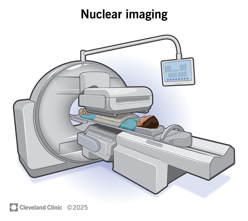 Nuclear Medicine Scan Machine Nuclear Medicine Scan Machine